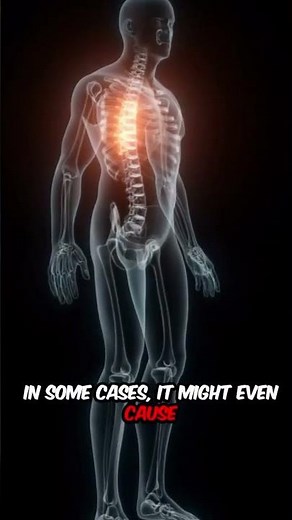 What is cervical rib.