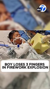 13K views · 201 reactions | Dangers of illegal fireworks: A horrific accident involving an illegal firework found on an Orange County street injured two young boys, one of whom lost three fingers. | ABC7 | Facebook