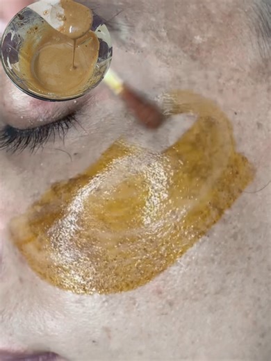 1.5M views · 6.4K reactions | Clean Dark Spots and Pigmentation ✨Try This Recipes That Truly Work Quickly! | Health Care Zone | Facebook