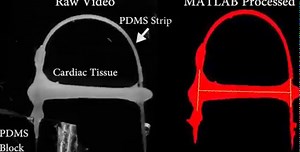 A new model of engineered heart tissue mimics mechanical forces placed on the heart more accurately than previous designs, allowing it to better model conditions such as arrhythmogenic cardiomyopathy. Read more from Science Translational Medicine: https://fcld.ly/c6at3pe | Science