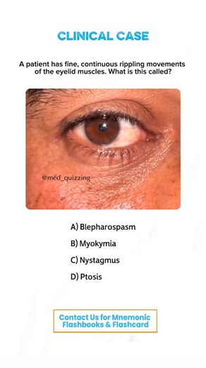 𝑴𝒆𝒅 𝑸𝒖𝒊𝒛𝒛𝒊𝒏𝒈 on Instagram: "Comment “Details” and check your inbox for the full mnemonic flashbook & flashcards! 📕✨ . . . . . . #medical #medicine #medicalstudent #medicinestudent #usmle #step1 #plab #mrcp #medicine #reels #viral #foryou #anatomy #reelexplore #instagram #neurology #nephrology #surgery #students #colleges #cardiology #knowledge #virals #plab #UK #USA #newyork #nyc #neet"