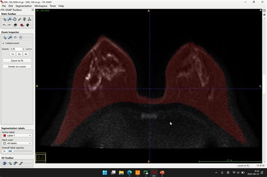 ITKsnap如何进行乳腺分割及基础操作教程