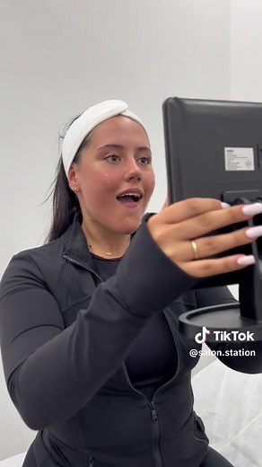 HIFU Treatment for a Youthful Lift at Salon Station