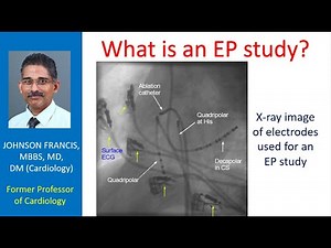 What is an EP study?