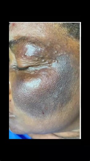 Sofia Skin Lightening Cream: Safe and Effective Solution