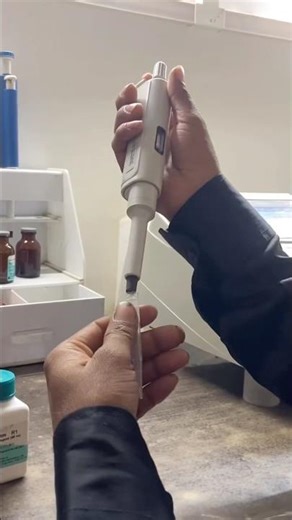 bilirubin test processing step by step ✅ #medical #viral