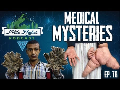 Unexplained Medical Mysteries - Podcast #78