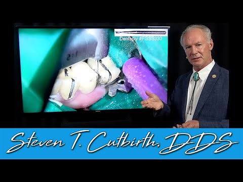 Removing Fixed Dental Bridge - Dental Minute with Steven T. Cutbirth, DDS
