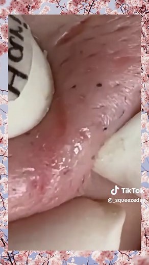 Squeeze Day no TikTok