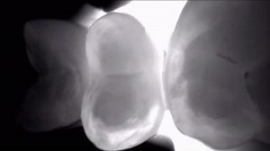 Keep your workflow in focus automatically - with the new Kavo...