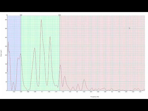 Heart Rate Variability with ADInstruments Labchart for PowerLab