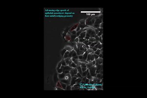 File:Advancing-Edge-Speeds-of-Epithelial-Monolayers-Depend-on-Their-Initial-Confining-Geometry-pone.0153471.s001.ogv - Wikimedia Commons