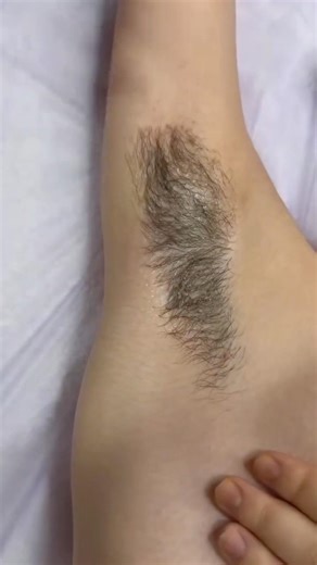 Hollywood Wax for thick Underaram // Thick Hair Underaram Waxing Tutorial #makeoverbyanita002 #wax
