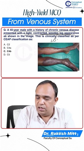 NEET SS Surgery MCQ | Lipodermatosclerosis (LDS) Explained by Dr. Rakesh Mittal #shorts
