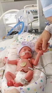 156K views · 81 reactions | TLC on Reels | Facebook