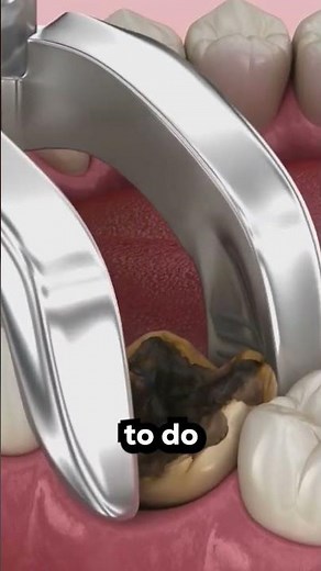 DAVID BLAINE's Tooth Pulling Magic Trick EXPLAINED!!!