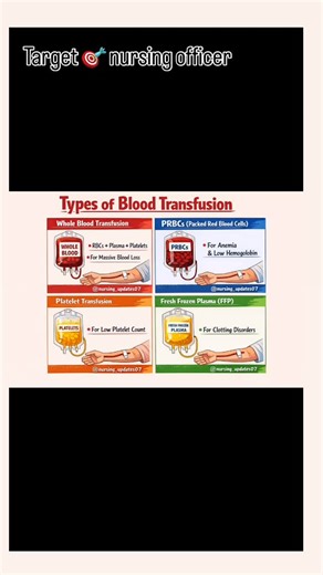 Nursing_ updates07 on Instagram: "🩸 Types of Blood Transfusion – Explanation (Nursing Notes Style) Blood transfusion is the intravenous transfer of blood or blood components from a donor to a recipient to restore blood volume, oxygen-carrying capacity, or clotting factors. 1️⃣ Whole Blood Transfusion Definition: Transfusion of blood containing RBCs + WBCs + platelets + plasma. Indications: Acute massive blood loss (trauma, surgery) Severe hemorrhage Exchange transfusion (rare) Advantages: Repla