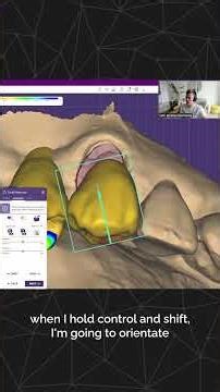 exocad Training Session - Seth Potter