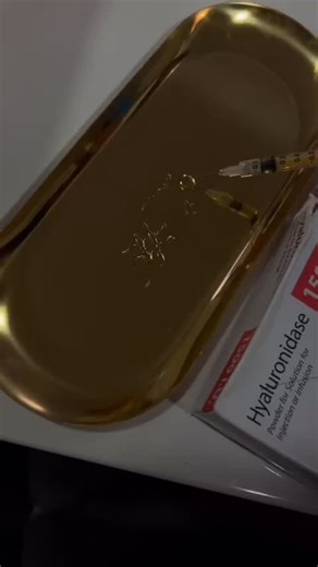 NO it won’t Its is a myth Here’s the clear, evidence-based explanation Hylase (hyaluronidase) does NOT break down your own collagen. It specifically targets hyaluronic acid (HA) — not collagen, elastin, or other structural proteins. Why the myth exists • Temporary volume loss: When hyaluronidase dissolves HA (including your natural HA), the area can look flatter or “deflated” for a short time. • Swelling going down: Once inflammation settles, people may notice their baseline anatomy more clearly