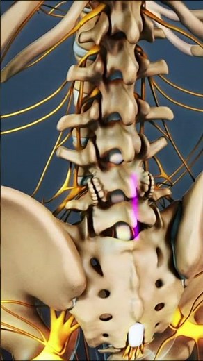 Lumbar Spine Breakdown: Discs, Vertebrae & Surgery Options