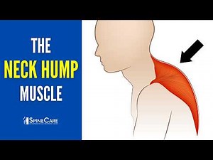 Release THIS Muscle to Fix Your Neck Hump