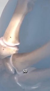 How Broken Thumb Surgery Is Done? #3danimation #medical | Leo Mike