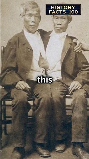Siamese Twins: One Body, One Incredible History