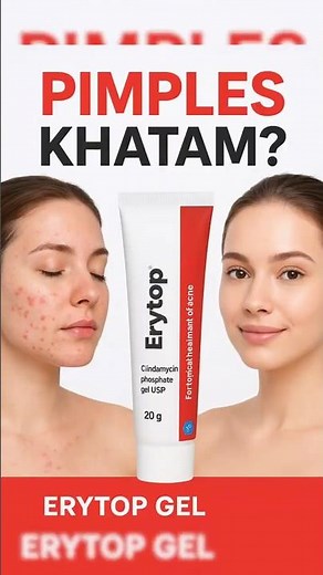 ERYTOP gel use | clindamycin gel use #pimples #acne #acnemarksremoval #skincare DRX SEVERON