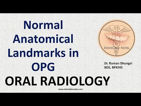 How to look and interpret Orthopantomogram