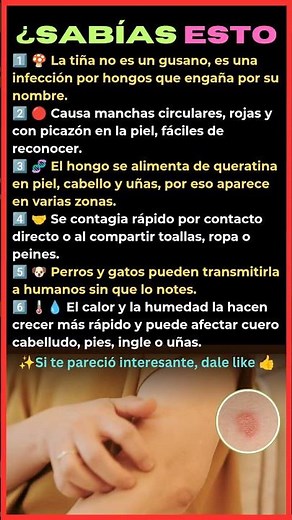 ¿SABÍAS ESTO? La Tiña NO es un Gusano 😱 | Infección por Hongos Explicada
