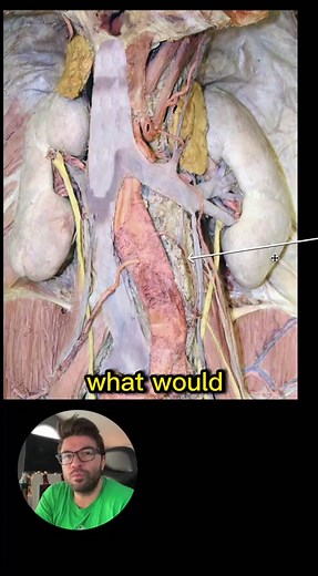 What is the structure? 🤔 ✅ post below if ya know!💯 #medschoolbootcamp #medicine #Medical #MedStudent #MedicalStudent #MedSchool #MedicalSchool