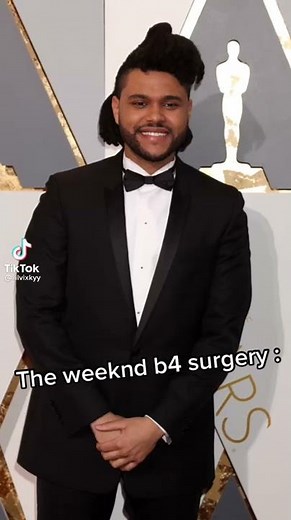 The weekend before and after plastic surgery 😂