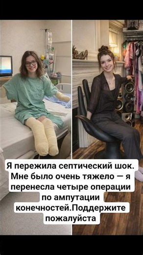 Я пережила септический шок. Мне было очень тяжело — я перенесла четыре операции по ампутации коне