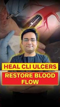 Diagnosis & Treatment to Save Your Leg | Critical Limb Ischemia (CLI) Explained