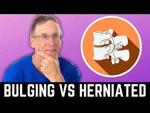 Exercises to Heal a Bulging Disc vs. Herniated Disc. The Difference?