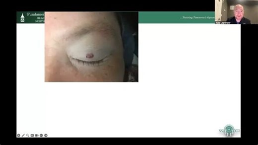 Optometric Surgical Procedures and Injections for Every Optometrist-眼科手术操作及注射技术