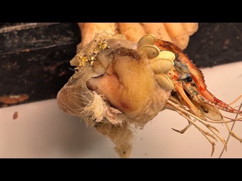 DOCTOR SURPRISED // Toenails super long, nails are deformed due to infection XV2651