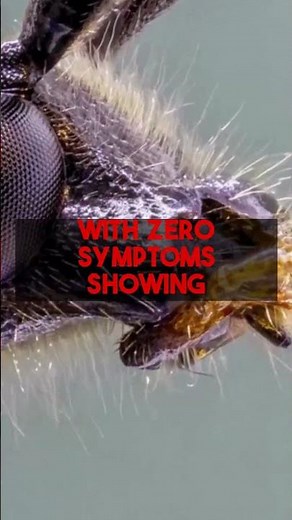 Understanding Herpes Simplex 1 Contagion Key Patient Insights