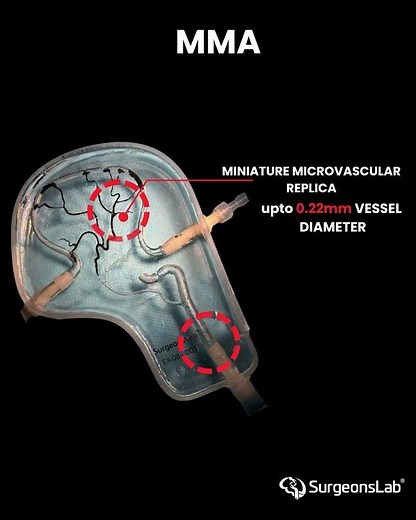 Microcatheter Navigation & Embolic Delivery: MMA Training | Microvascular Mastery: MMA Embolization