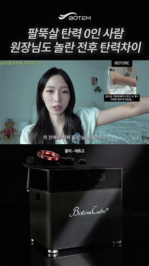 팔뚝살 탄력0인 사람 원장님도 놀란 전후 탄력차이