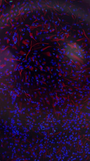 Exploring Human Brain Cells Under the Microscope