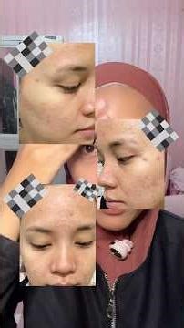 Di Tm1 mager parah, saatnya di Tm2 harus rajin skincarean lg😉 #bumil #shortvideo #skincareroutine