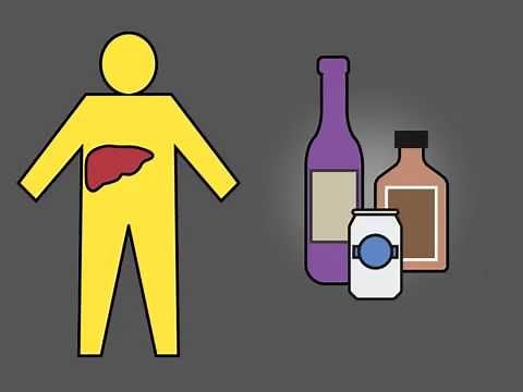 Pentoxifylline or Prednisolone