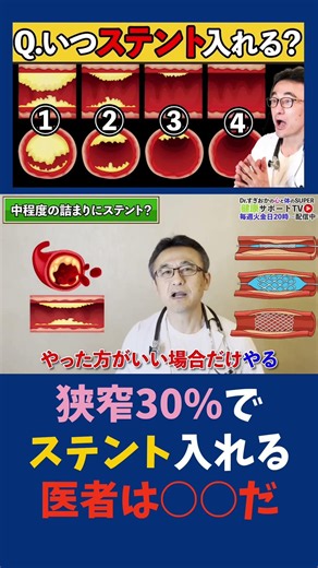 こんな医者は🙅【動脈硬化】心臓のステント治療メリットと危険性を正しく理解しよう！循環器内科医が解説 #すぎおかクリニック #船橋市