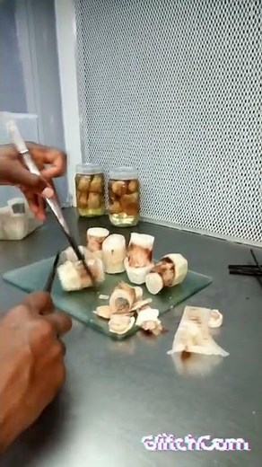 INOCULATION OF BANANAS IN TISSUE CULTURE.