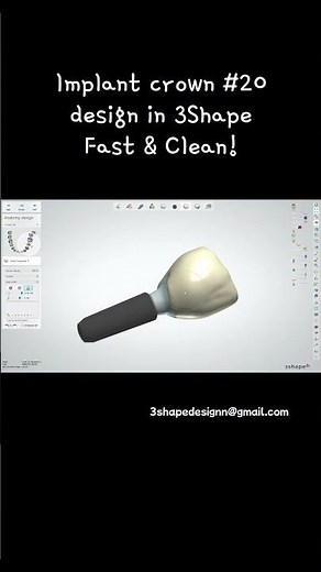 3shape design implant crown #20