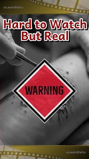 Maggots That Heal #ulearndaily #educational #facts #shorts