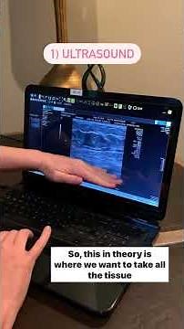 Let's Take A Closer Look At 3 Types Of Breast Imaging Tests