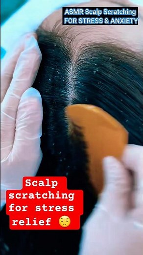 Asmr scalp scratching for stress relief😌 #asmrscalpscratching #asmrscalp #scalpcare ‪@ASMRRebecca‬