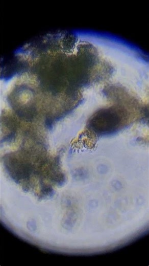 Rotifer specimen at 40x magnification using the Cilika Digital Microscope #DigitalMicroscopy